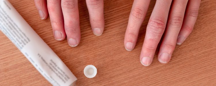 Hands beside anti-inflammatory medication tube
