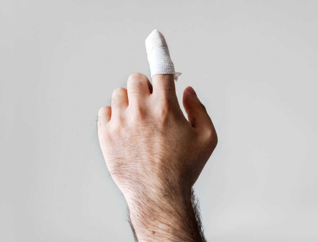 Jarred Finger Injuries