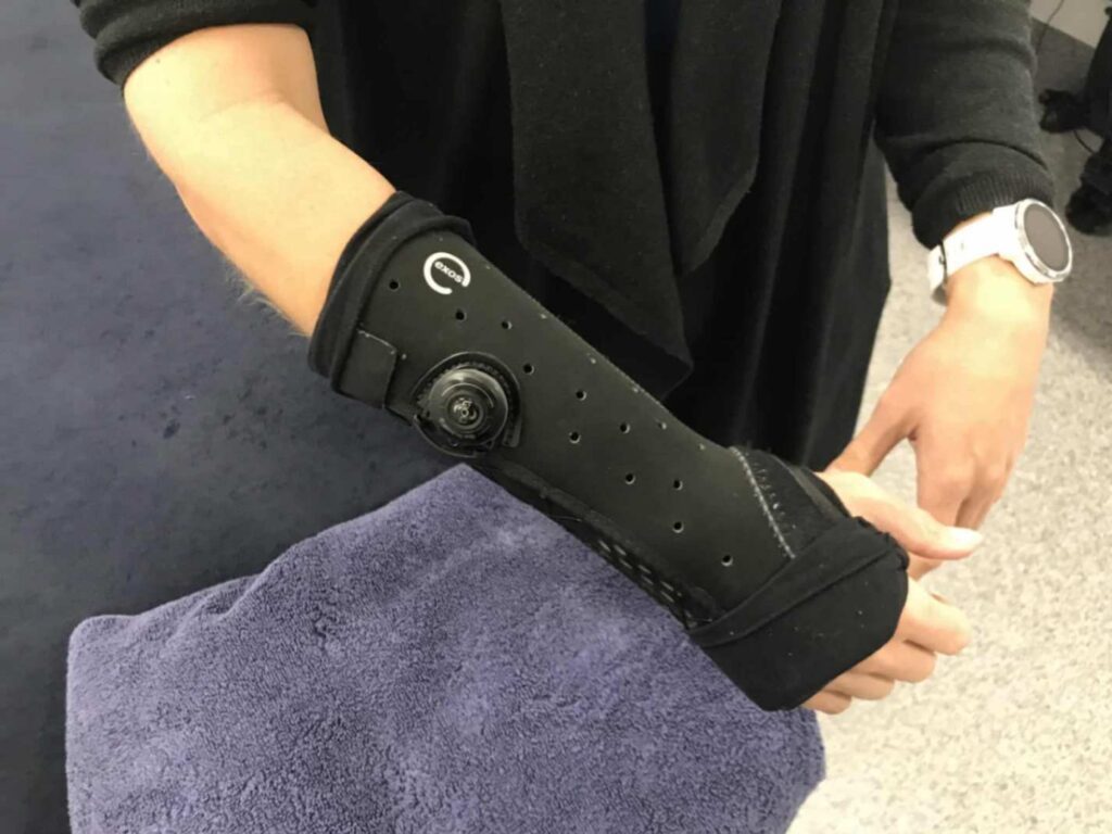 Exos splints