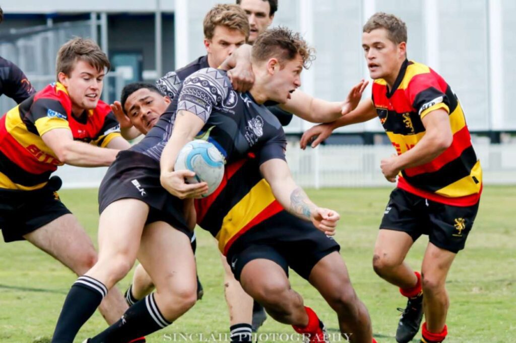 Common rugby injuries