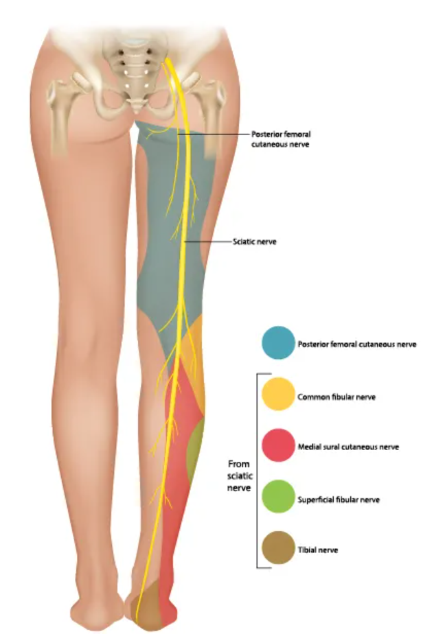 Diagram of the sciatic nerve running from the lower back through the hip and down the back of the leg